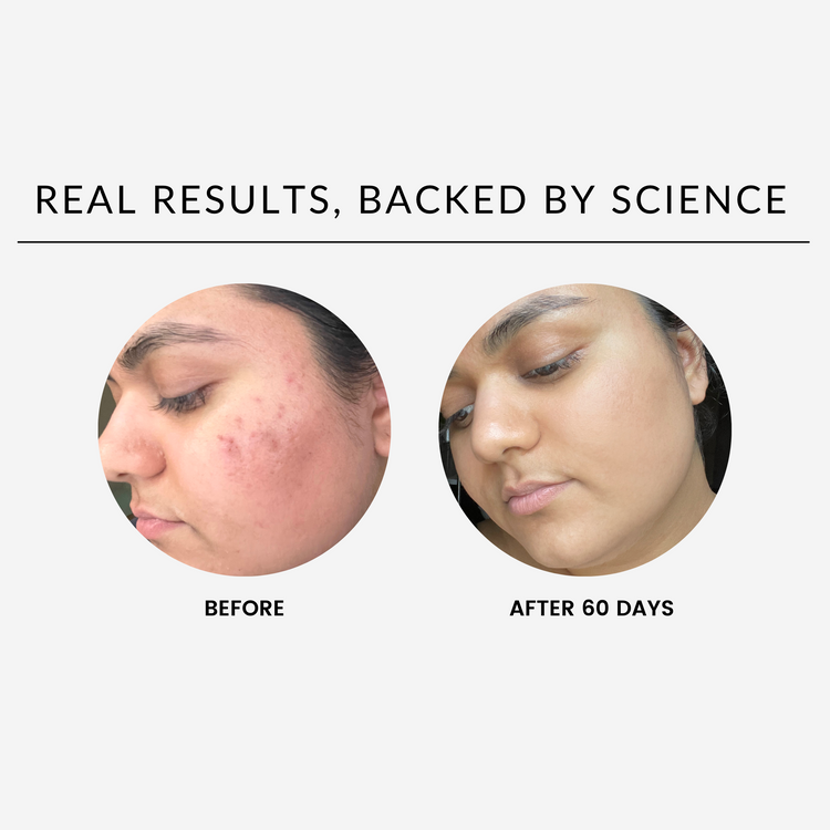 (NEW) THE DUO - Vitamin C Serum and Niacinimide DC-SHAYDE BEAUTY