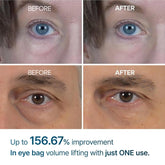 Eyephalt Miracle Repair Cream – EGF-Infused Under Eye Savior (0.33 Fl.Oz)
