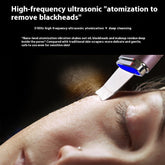 Ultrasonic Blackhead Remover Glowing Skin Beauty Essentials